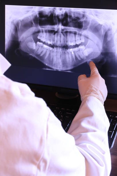 Best Knocked-Out Tooth (Avulsed Tooth) Treatment in Beech Island, SC