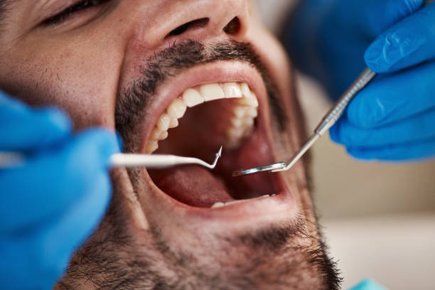 Professional Emergency Dental Service in SC